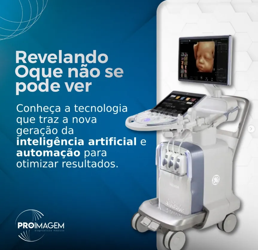 Novo Ultrassom com Inteligência Artificial na ProImagem. 